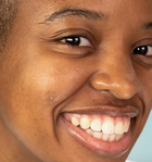 Spot AM Pimple Patches